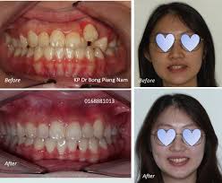 Dr.Bong Piang Nam Dental Surgery