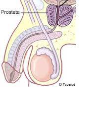 Explains prostate problems including prostatitis and benign prostatic hyperplasia. Prostata Cancer Home Facebook