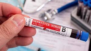 Oleh karena itu, penderita hepatitis b kronis perlu melakukan kontrol secara berkala ke dokter untuk mendapatkan penanganan dan deteksi dini bila hepatitis b sering kali tidak menimbulkan gejala, sehingga penderitanya tidak menyadari bahwa dia telah terinfeksi. Mengenal Hepatitis B Berikut Gejala Gejala Dan Cara Mencegahnya Tribun Jatim