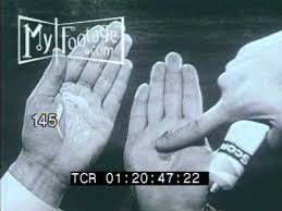 Image result for HAIR Score