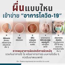 อาการทั่วไปของโรคโควิด 19 พี่พบมากที่สุดคือ ไข้ ไอ และอ่อนเพลีย อาการที่พบน้อยกว่าแต่อาจมีผลต่อ. Usrc Ek Kja7dm