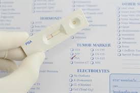 Prostate cancer often has no symptoms until the disease is advanced, and screening may help detect cancer early … Cancer Screening And Early Detection Mcmaster Optimal Aging Portal