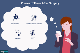 We did not find results for: When Does Fever After Surgery Become A Concern