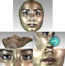 Correlation between facial morphology and gene polymorphisms in the Uygur  youth population