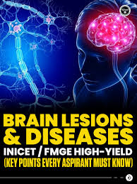 Image result for Neurologic Lesion Localization