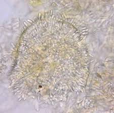 Image result for Anthericopsis