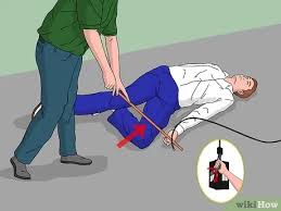 كيفية علاج الحروق الكهربائية صور توضيحية Wikihow