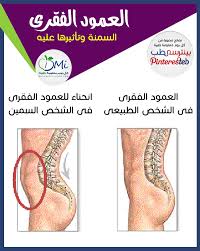 فعلا الكرش هو حمل ثقيل على كل جسمك وبالأخص عمودك الفقرى شاهد الصورة وتعرف على تأثير السمنة الضار على سلامة عمودك الفقرى لو أعجبتك المعلومة اضغط Repin تابع مع