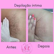 Studio Shauana Carvalho Depilacao Intima Utilizando Cera Marroquina Ideal Para Preservar A Saude Da Pele Agende Ja Seu Horario Facebook