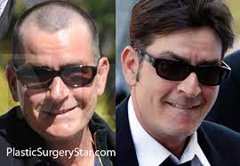 Charlie Sheen Hair Piece Off 72 Quality Assurance