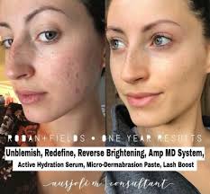 Love Your Skin with Jeanette Shibata, R+F Independant Consultant