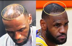 ALL AT THEIR BEST KINGS Raplors DALL& 20 CAVS 12 25 WHO YOU TAKING FIRST?