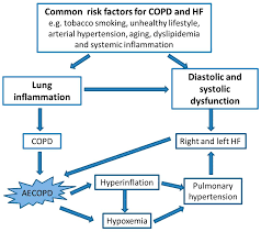 Image result for COPD Exacerbation Decision Tool
