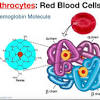 Thrombocytosis is a condition in which there are an excessive number of platelets in the blood. 1