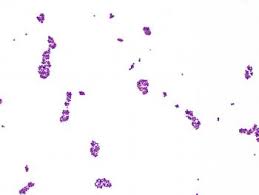 Salmonella ou escherichia coli), vírus (ex: Intoxicacao Alimentar Por Estafilococos Disturbios Digestivos Manual Msd Versao Saude Para A Familia