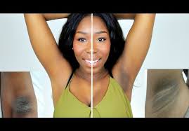 Take 2 tablespoons of natural sugar, 1teaspoon lemon juice, and 1 egg white. Armpits Update Lighten Dark Underarms Elbows Knees Fast With Kojie Acid Soap