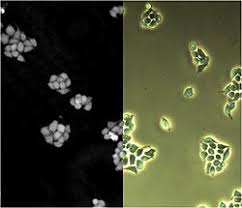 Dreamstime is the world`s largest stock photography community. Microscopy Wikipedia