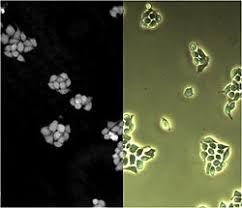 Examine a variety of cells with the compound microscope and estimate cell size. Microscopy Wikipedia