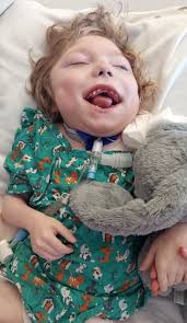 Mother shares son's transformation pictures