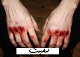 ابي صورة فيها يد مجروحه و اكتبي عليها تعبت عطيتك لايكات Ask Fm Foto 3