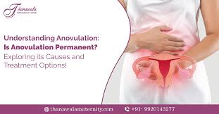 Image result for Anovulation