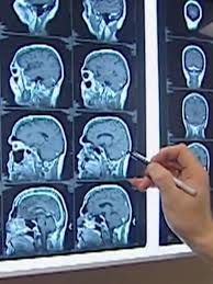 Heiße Ampel-Show!: OnlyFans-Model entblößt Hintern vor Autofahrern