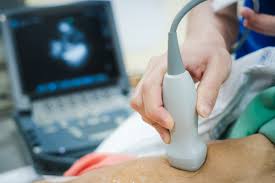 Critical Care Ultrasound