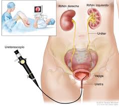 Parmi les cancers de la tête et du cou, on appelle généralement cancers de la gorge ceux qui se forment dans le larynx ou dans le pharynx. Cancer La Gat Ultima Faza Cancer La Gat Ultima Faza Metastaza Ce Sunt Metastazele Canceroase Mai Exact