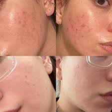 She was very informative and helpful with figuring out the . Skin Deep Aesthetics Women Owned 21 Photos 13 Reviews Cosmetics Beauty Supply 17029 Chatsworth St Granada Hills Ca Phone Number Yelp