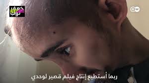 عانى خير الدين من مرض جيني في طفولته.. فلم يجد القبول من الشارع بسبب شكله  #DW