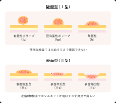56732 12 3 4 5 6 7 8 9 10. å¤§è…¸å†…è¦–é¡æ¤œæŸ» å¤§è…¸ã‚«ãƒ¡ãƒ© å†…è¦–é¡æ¤œæŸ» æ¨ªæµœå¸‚ã®è‹¦ã—ããªã„å¤§è…¸ èƒƒå†…è¦–é¡æ¤œæŸ»ã®å°‚é–€åŒ» é–¢å†…éˆ´æœ¨ã‚¯ãƒªãƒ‹ãƒƒã‚¯