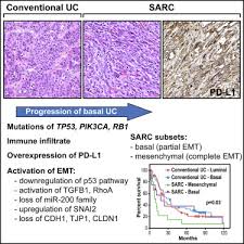 The software is still available to download from the google play store and in fact receives a large number of downloads each and every day. Dysregulation Of Emt Drives The Progression To Clinically Aggressive Sarcomatoid Bladder Cancer Sciencedirect