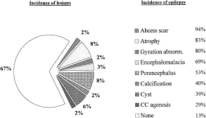 Pie Chart Depicting The Relative Frequency Of Epilepsy In