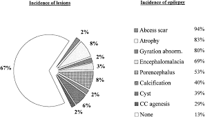 pie chart depicting the relative frequency of epilepsy in