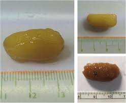 Someone believes he sees a ghost. Ghost Tablets Mimicking Intestinal Parasite