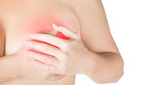 Top 2 pictures are prior the first chemo. Is It Just A Rash Or Inflammatory Breast Cancer Norton Healthcare Louisville Ky