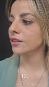 Celebra el Mes de la Madre regalándote el cuidado que mereces. Aprovecha  esta oportunidad para realzar tu belleza de manera natural y lucir unos  labios espectaculares. 💉💋, ¡Es el momento perfecto para ...