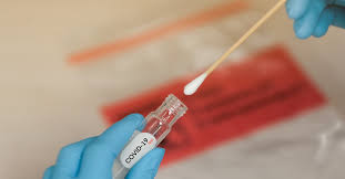 The two main branches detect either the presence of the virus or of antibodies produced in response. Farmacias No Rio Vendem Ilegalmente Testes Rapidos Para O Covid 19