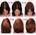 Before And After Minoxidil Hair