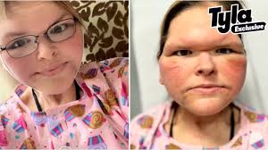 Tammy Slaton's surgeon reveals 'hardest moment' of skin removal surgery  process after dramatic transformation