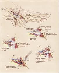 Pin On Fit Chicks Get Injured Or Sick Too