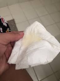 Flujo Despues De La Cuarentena Bebes De Agosto 2014 Felices 4 Anitos A Todos Los Bebes Pagina 5 Babycenter