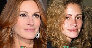 Tip Refined On Julia Roberts Nose Job Plastic Surgery Rhinoplasty