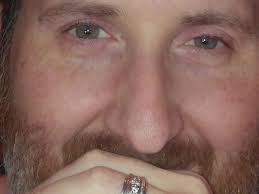 Fundraiser by Malinda Allen Appelman : A new heart for Paul