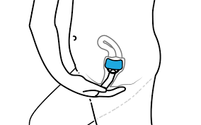 Como Utilizar Un Capuchon Cervical Instrucciones Faciles De Seguir
