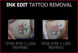 Tattoo my photo editor 2.0. Ink Edit Tattoo Removal Home Facebook