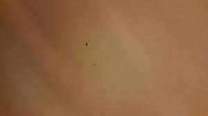 Bed Bug Black Bugs In Hair Pictures Little Black Bugs Could Be Scabies Scabies Blepharitis Bugs