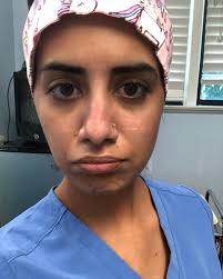 The first week of the new normal comes to an end. I guess we gotta get used  to the new PPEs after all. I'm glad to be back in clinic doing my