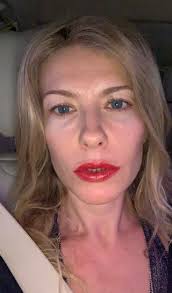 Gene Rubinstein, MD, FAAD, Board Certified Dermatologist