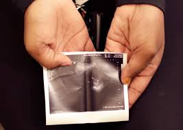 6464 john ryan dr suite a. Planned Parenthood Sues Texas City Over Abortion Ban Reuters